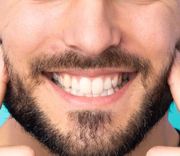 Man with beard pointing at his jaw joints and smiling