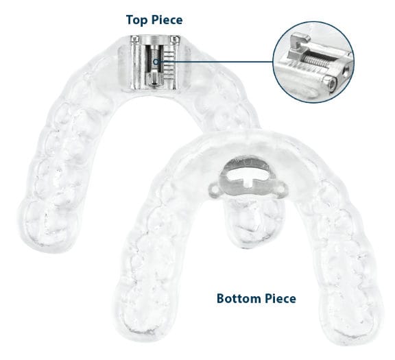 An exploded view of the TAP3 appliance showing the upper and lower sided of the mouthpiece